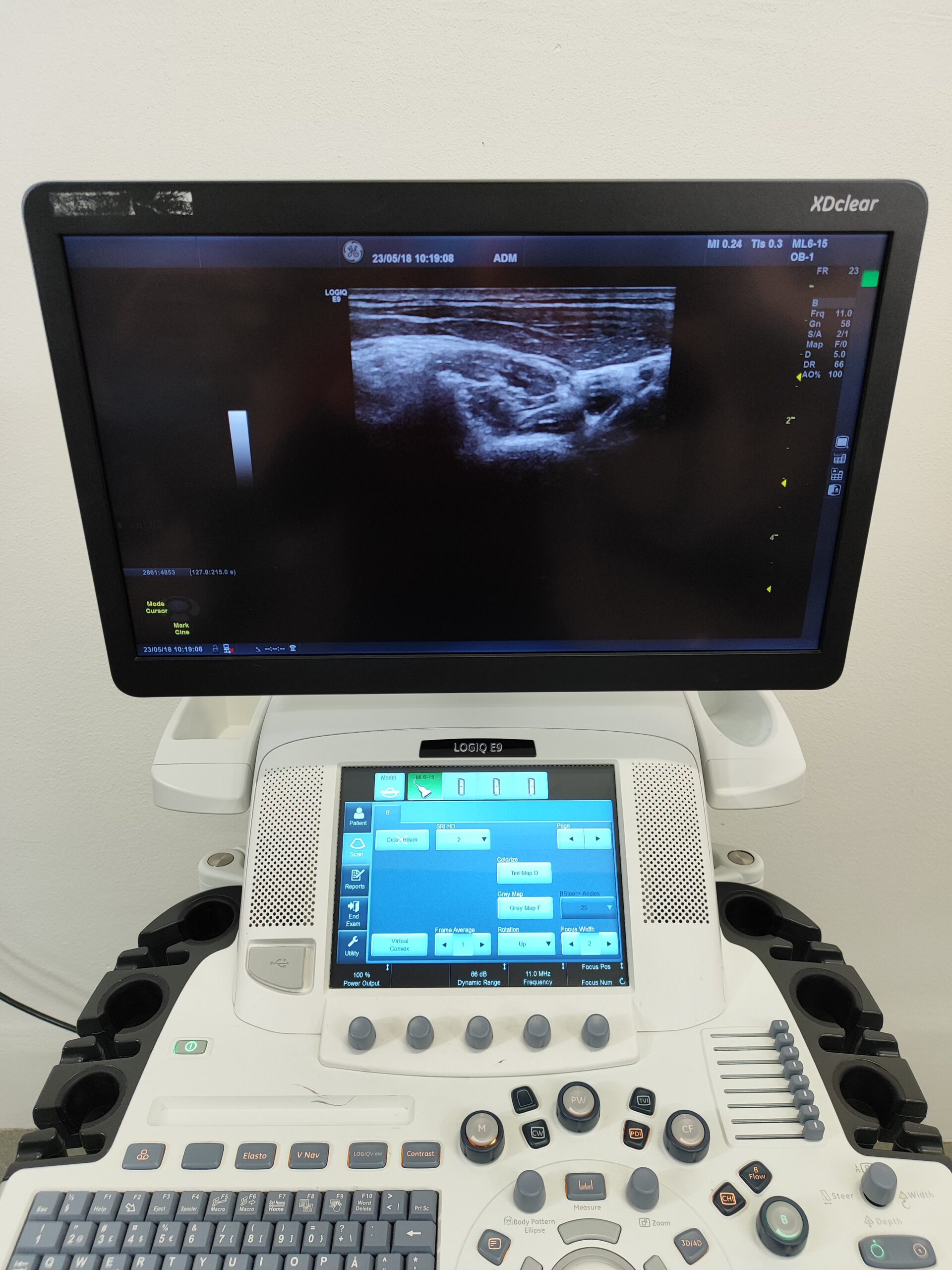 Ultrasonograf GE Logiq E9 XDclear – 2017